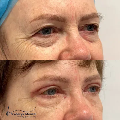 Medeste Clinic Legnica - Medycyna Estetyczna